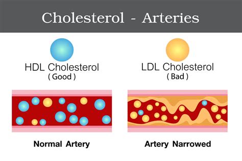 Human Cholesterol